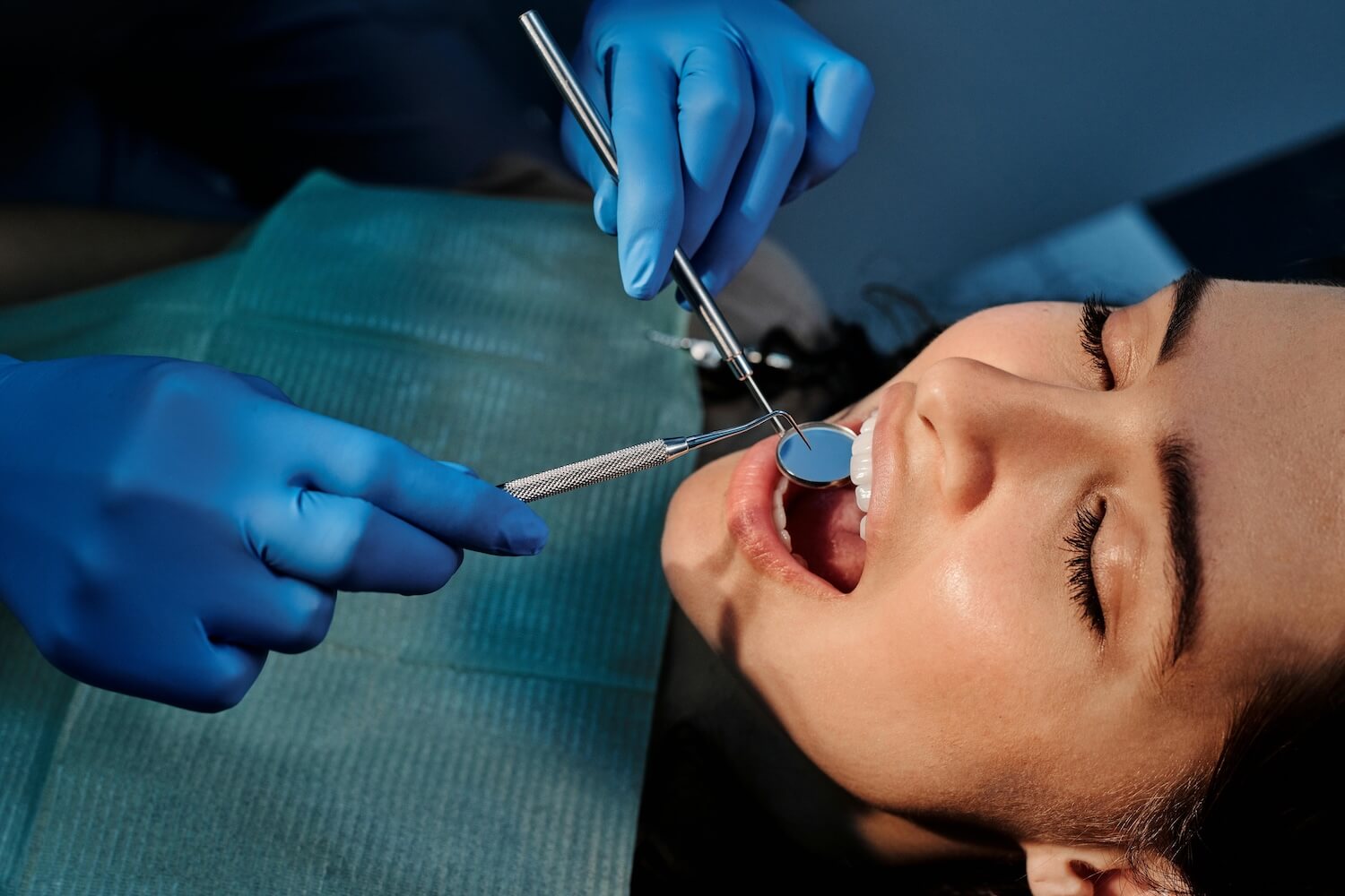 Dental Implants