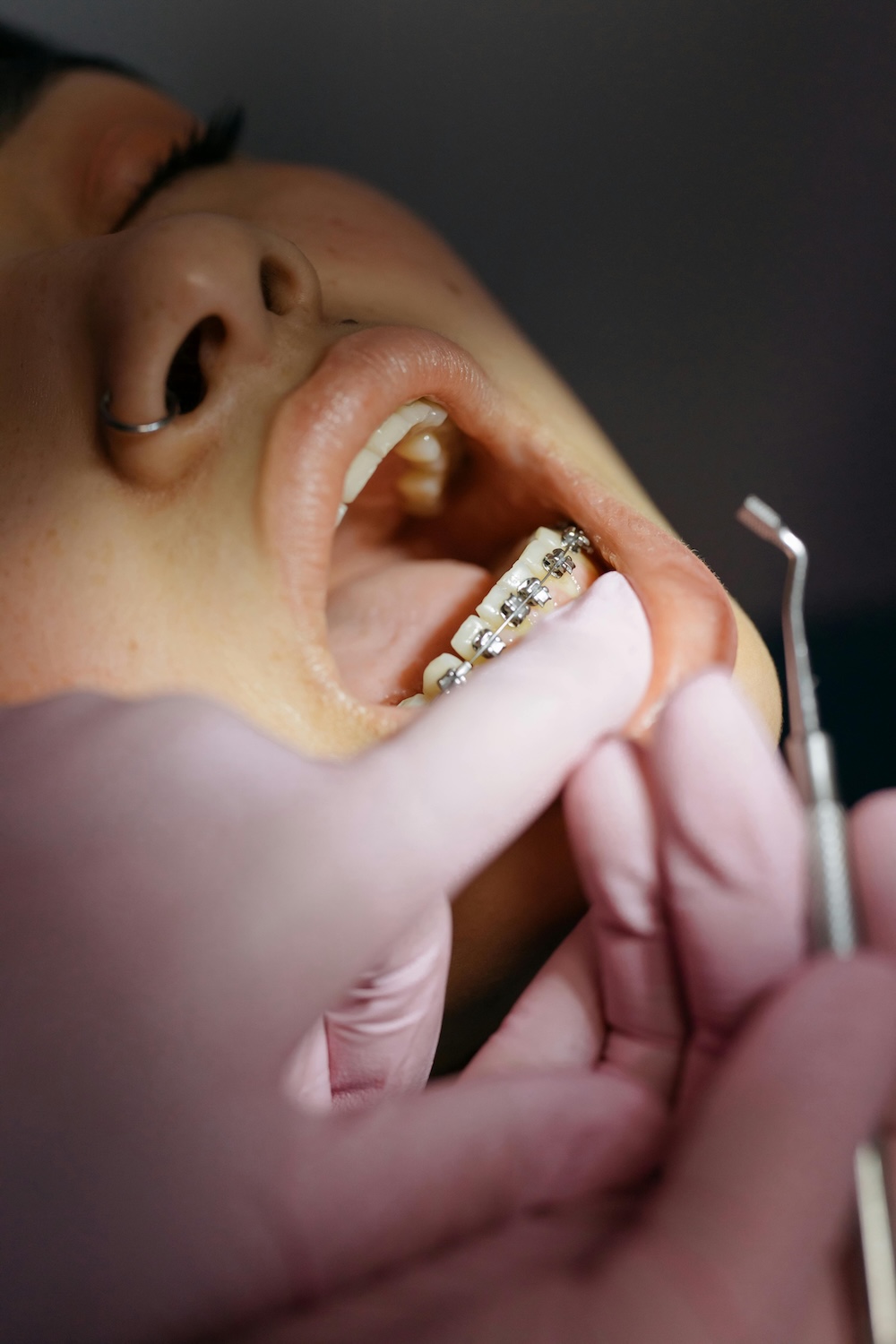 Orthodontic Care